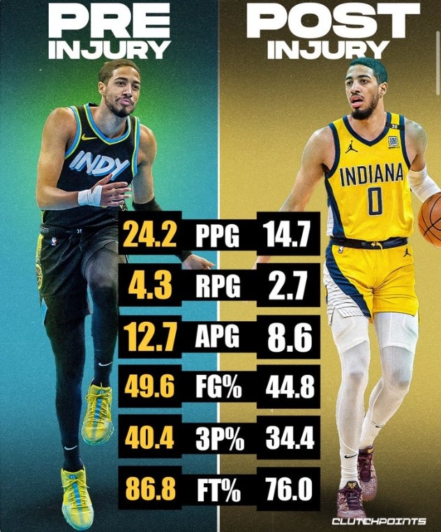 哈利伯顿本赛季受伤前场均24.2分4.3板12.7助 受伤后数据大幅缩水