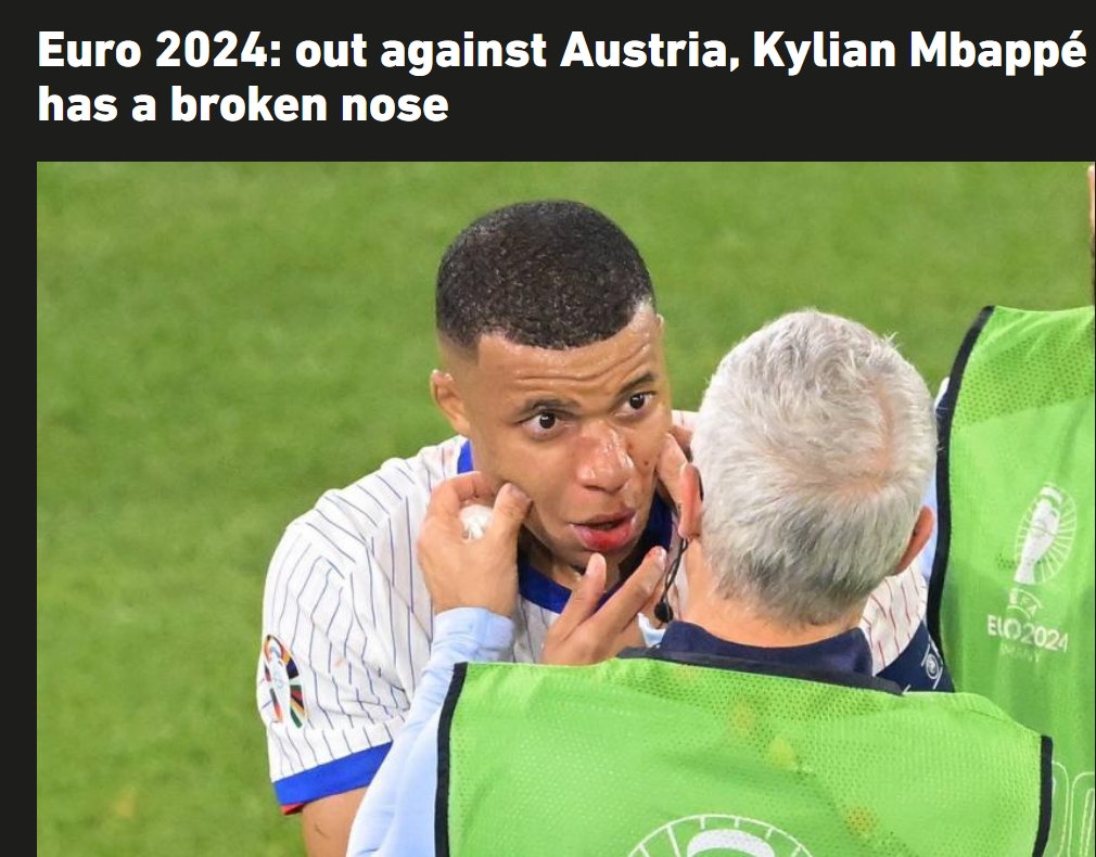 法国危队报：姆巴佩鼻骨骨折赛后送医治疗，将决定是否手术